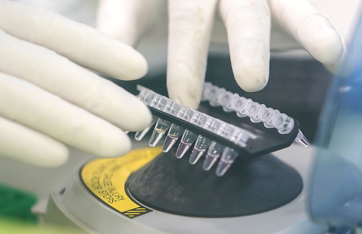 China's Progress Offers Hope, Experience for Europe's Virus Fight China's Progress Offers Hope, Experience for Europe's Virus Fight